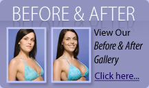 Before & After Gallery