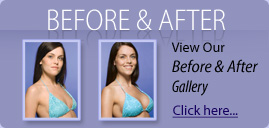 Before & After Gallery