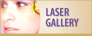 Laser Gallery