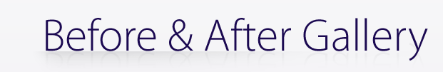 Before & After Gallery