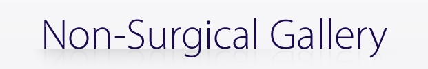 Non-Surgical Gallery